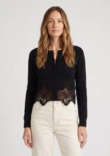 Lace Trim Button Front Cardigan: BLACK / S