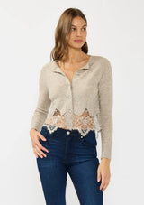 Lace Trim Button Front Cardigan: BLACK / S